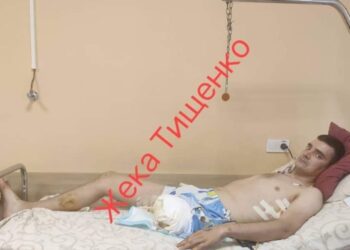 Термінової допомоги на лікування потребує поранений на полі бою шосткинець: захисник залишився без ноги