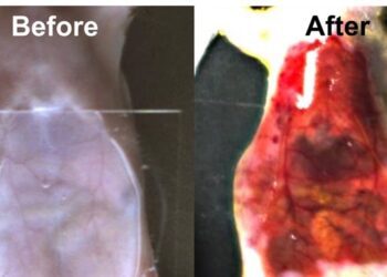 Вчені знайшли спосіб зробити шкіру та м язи прозорими