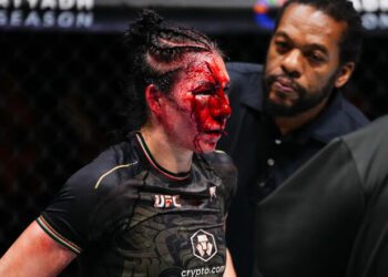 ВІДЕО 18+. Страшне розсічення. Який вигляд має лице Алдани після операції