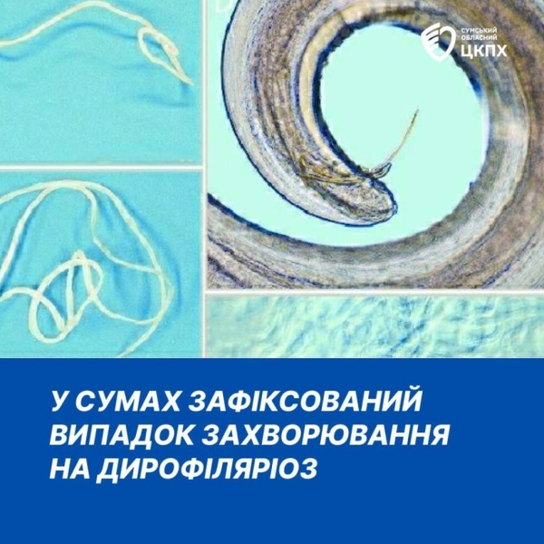 На Сумщині цього року зафіксований перший випадок захворювання на дирофіляріоз