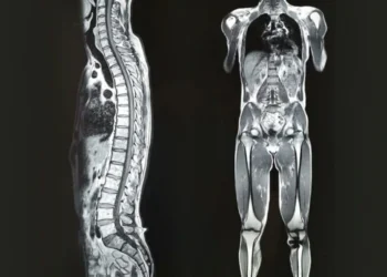 Консультація нейрохірурга