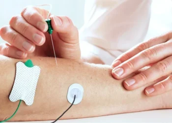 Електронейроміографія верхніх кінцівок київ