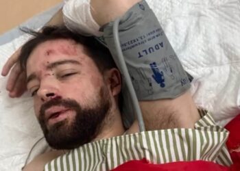 В поліції розповіли, як львів’янин, якого забрав ТЦК, міг опинитись з травмами на трасі