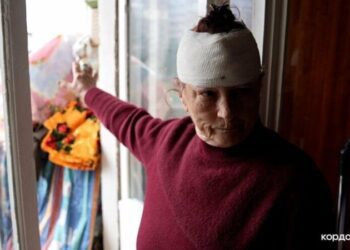 «Тепер, коли чую вибухи, у мене панічний страх»: історія сумчанки, яка постраждала від вибуху 24 березня