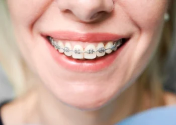 мезіальний прикус лікування брекетами