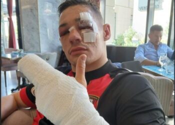 Кріс Біллам-Сміт: “Після поразки розмір гонорару за бій впав колосально”