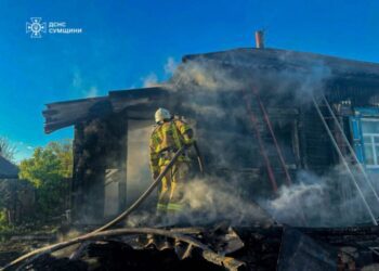 На Конотопщині внаслідок пожежі травмувався чоловік