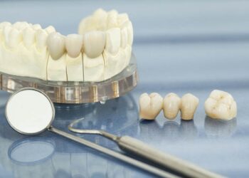 Відновлення зубів керамікою: сучасний підхід до естетики та функціональності