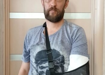 З мешканцем Шостки стався нещасний випадок. Терміново потрібна допомога!