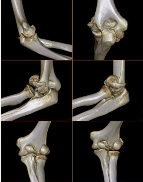 З мешканцем Шостки стався нещасний випадок. Терміново потрібна допомога!