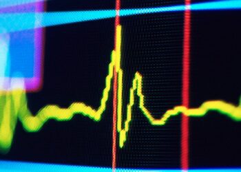 Ритм у пульсі людини може сигналізувати про майбутнє когнітивне погіршення