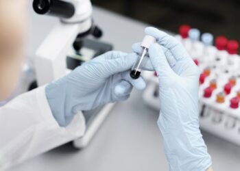 Лабораторна діагностика ризиків інфаркту та інстульту у Шостці