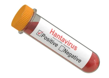 На Сумщині зафіксували перший випадок хантавірусу