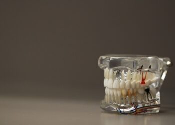 Вчені створили гель, який відновлює зубну емаль без фтору