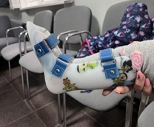 Забезпечення допоміжними засобами реабілітації