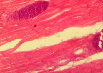 Чому важливо досліджувати м’ясо на саркоцистоз?