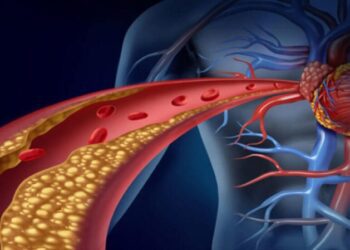 Лабораторна діагностика ризиків інфартку та інсульту за акціною ціною в Шостці