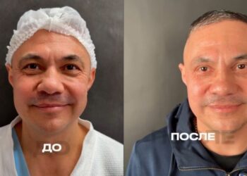 Костя Цзю зробив пластичну операцію