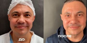 Костя Цзю зробив пластичну операцію