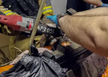 Рятувальна операція в приймальному відділенні: у Сумах визволяли чоловіка з «пастки» мотокультиватор