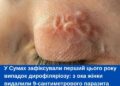 У Сумах зафіксували перший цього року випадок дирофіляріозу