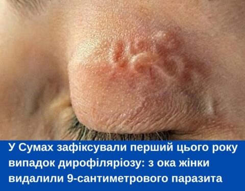 У Сумах зафіксували перший цього року випадок дирофіляріозу