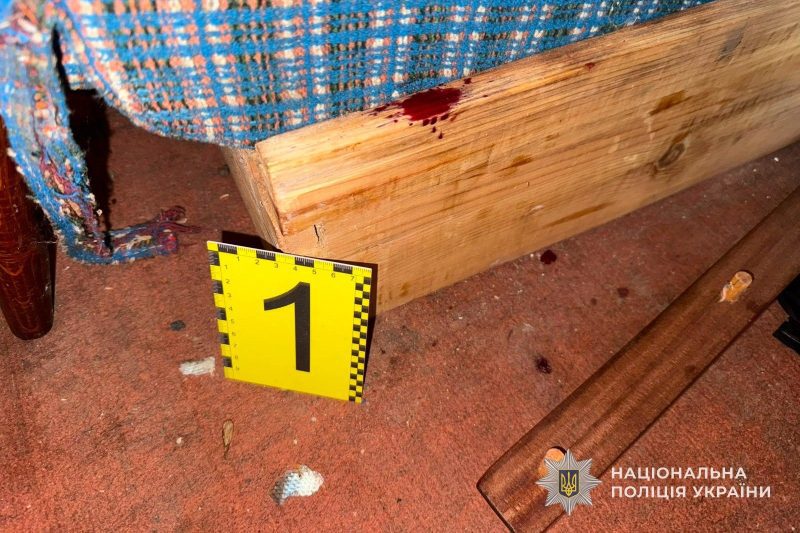 На Сумщині 4-річний хлопчик опинився в реанімації після побиття нетверезим чоловіком