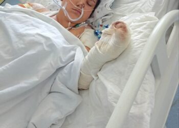 Понад місяць боролася за життя: у лікарні померла 12-річна Саша із Зноб-Новгородського, яка отримала опіки унаслідок атаки БпЛА