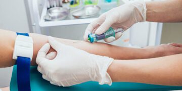 Лабораторна діагностика онкопатологій молочних залоз. Онкомаркер СА 15-3. усього за 199 грн
