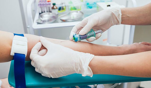 Лабораторна діагностика онкопатологій молочних залоз. Онкомаркер СА 15-3. усього за 199 грн